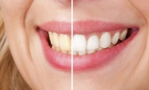 dientes 1